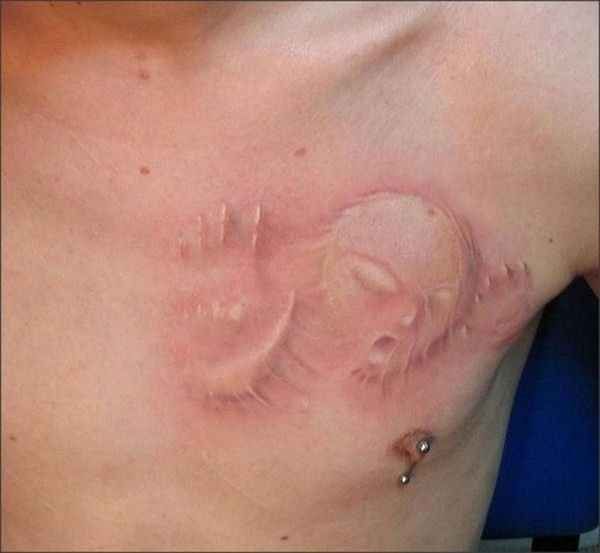 Alien Implants Tattoo On Chest