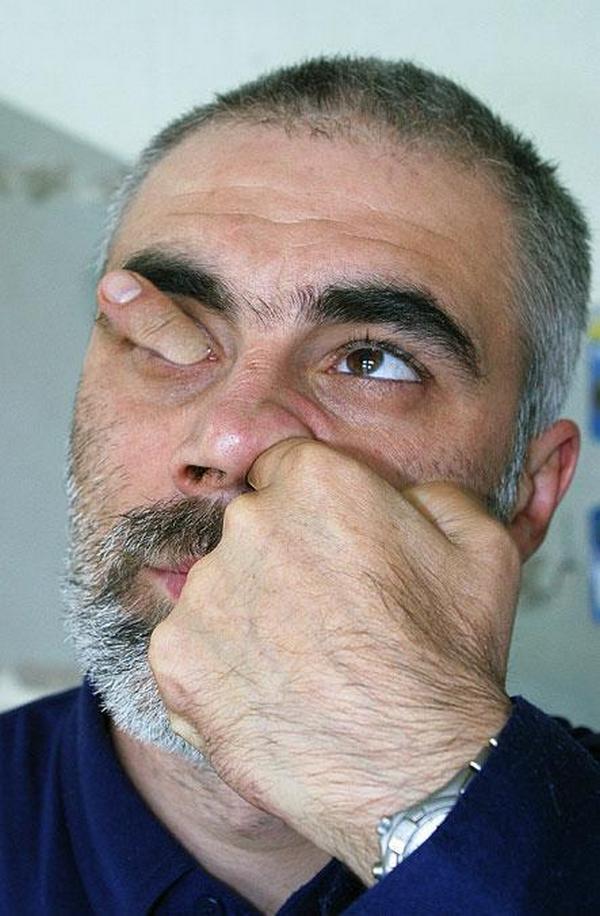 Man Passing Finger In To Nose And Eye