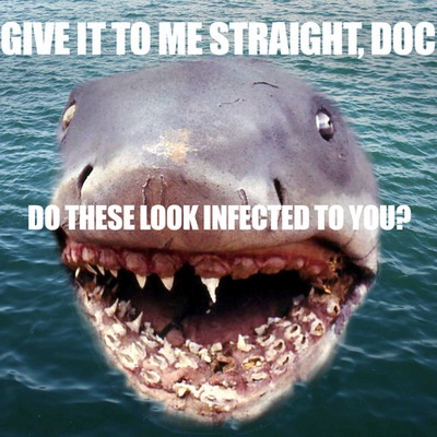 Do These Look Infected To You Funny Shark Meme