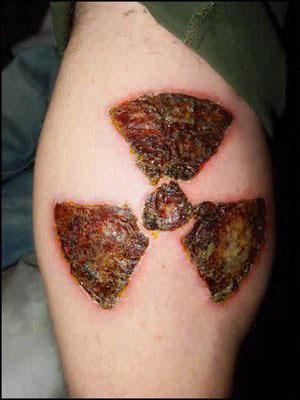 Ripped Skin Radioactive Symbol Tattoo Design