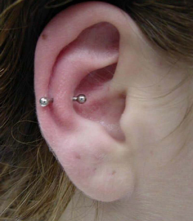 Silver Barbell Snug Piercing On Girl Right Ear