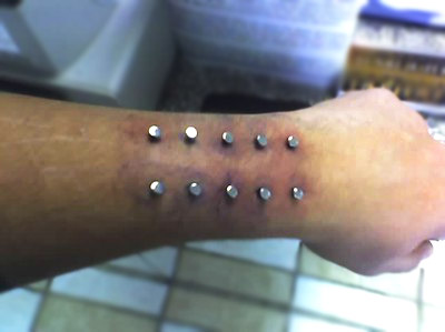 Surface Wrist Piercing With Dermal Anchors