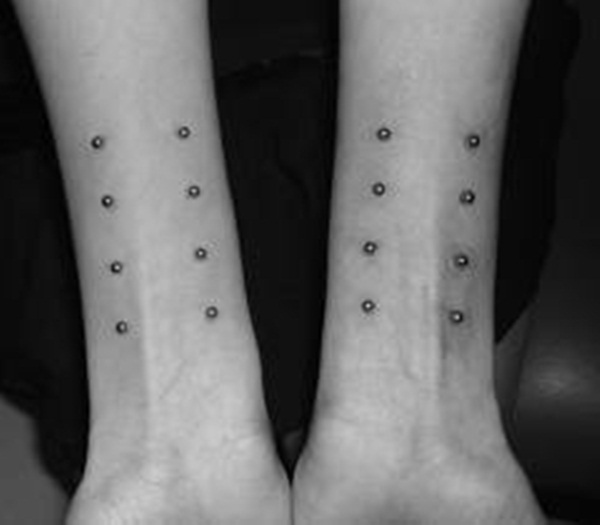 Surface Wrist Piercings On Both Arms