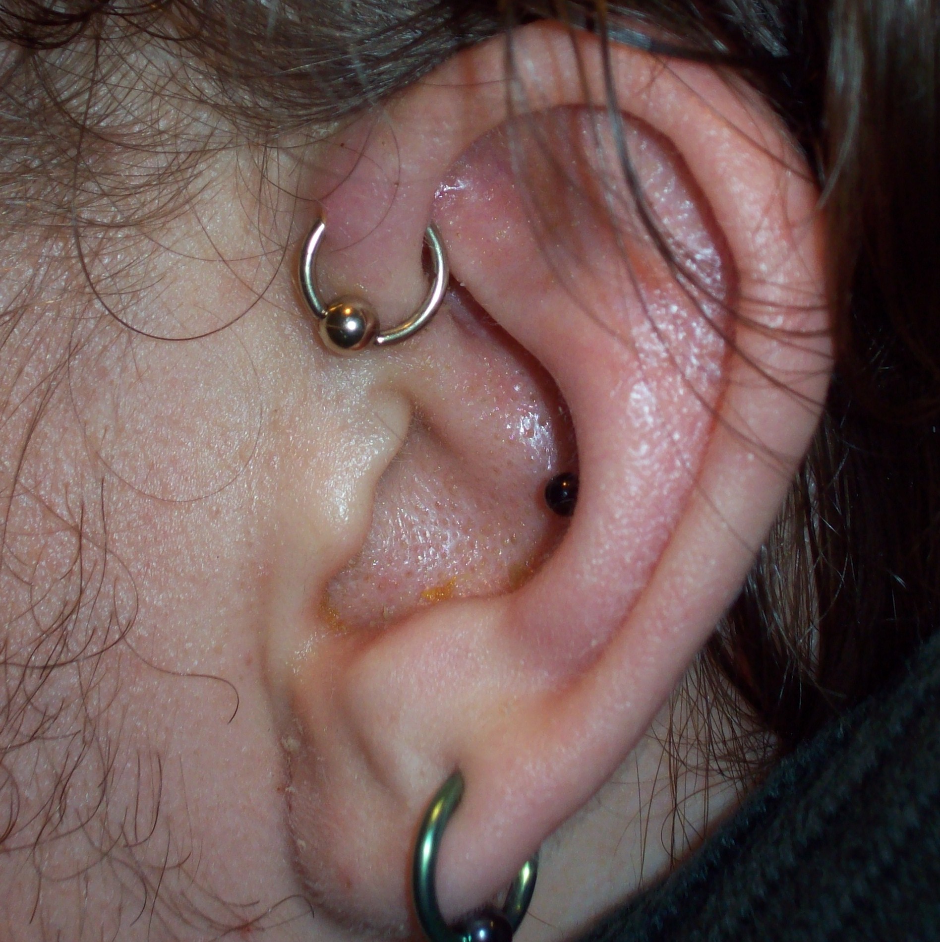 Anti Helix Piercing With Gold Ring