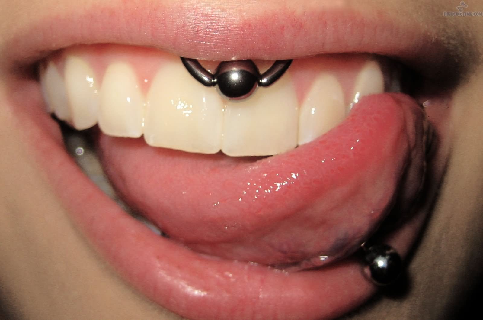 60+ Smiley Piercing Examples for a Life Smiley Piercing: Pictures, Pros, Co...