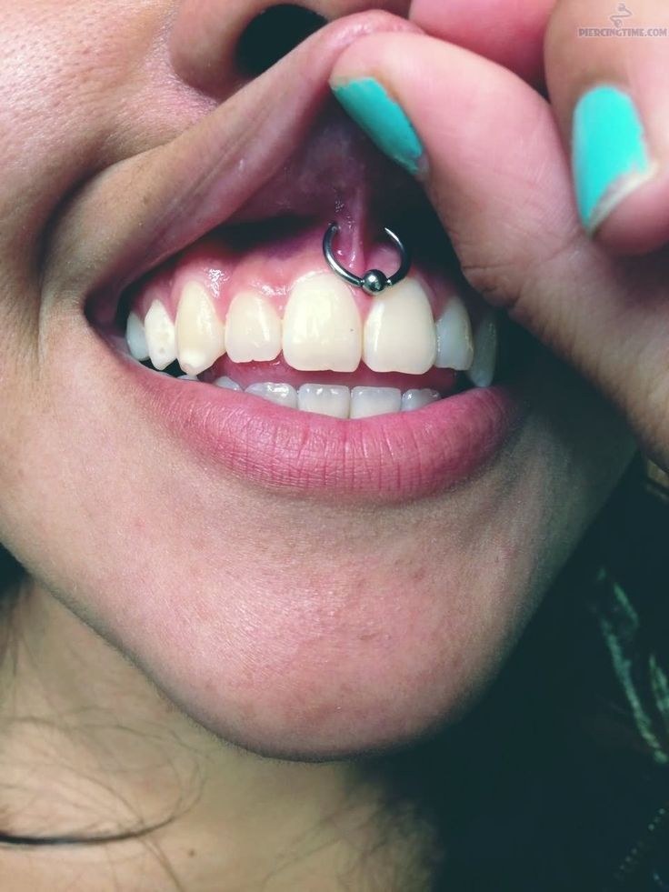 Girl Showing Her Smiley Piercing With Silver Bead Ring