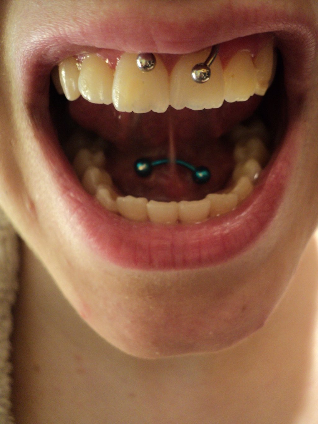 Lip Frenulum And Tongue Web Piercing by Luckyjellyfish