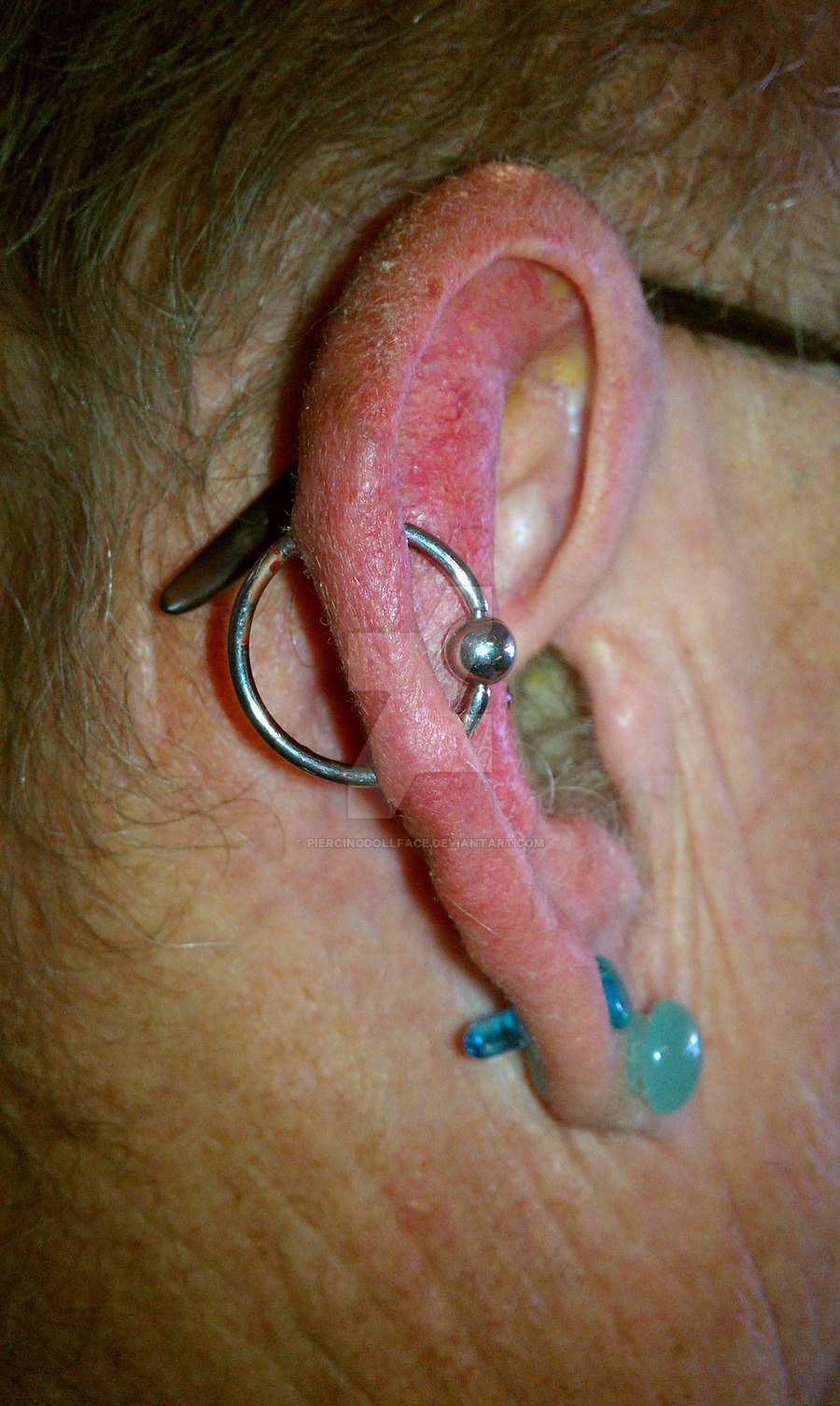Orbital Piercing On Right Ear by piercingdollface