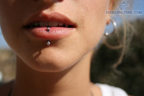 Vertical Labret Piercing With Single Surface Barbell