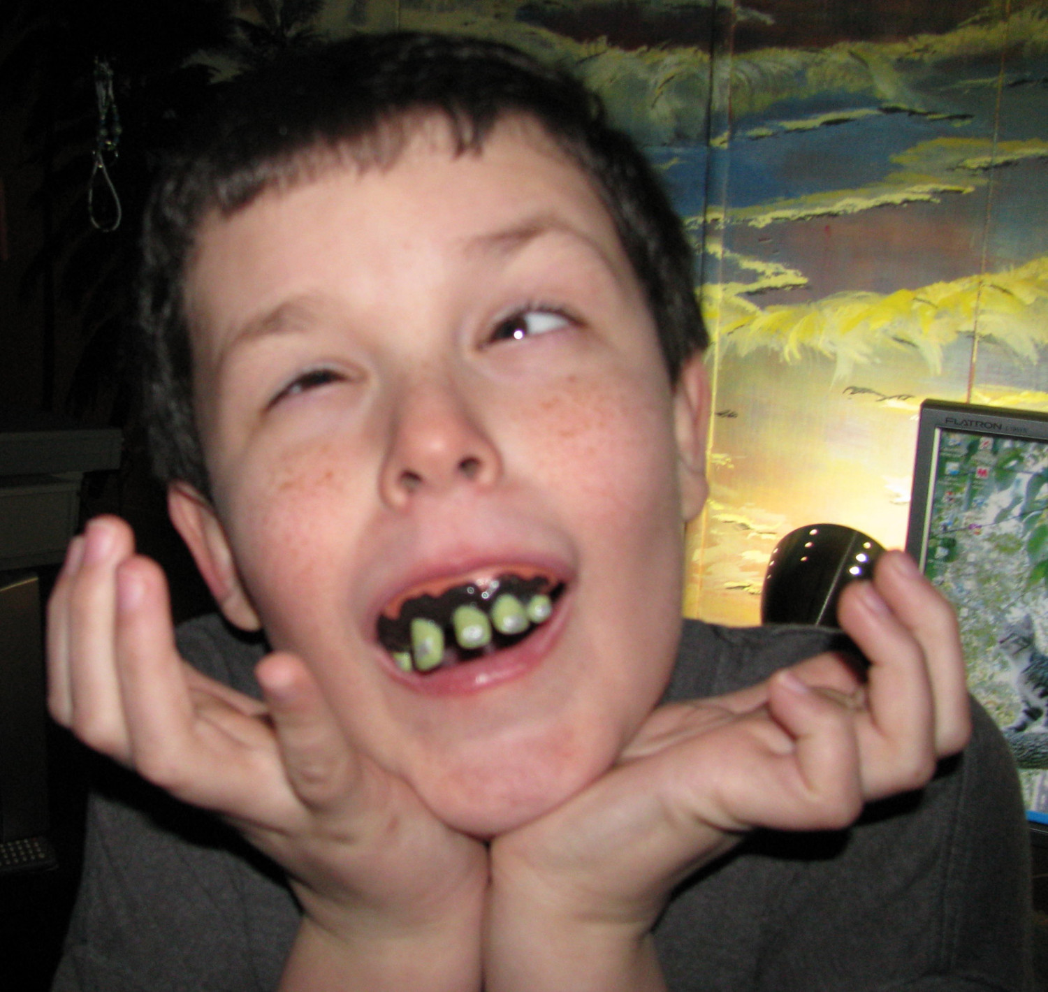 Boy With Weird Teeth Funny Picture