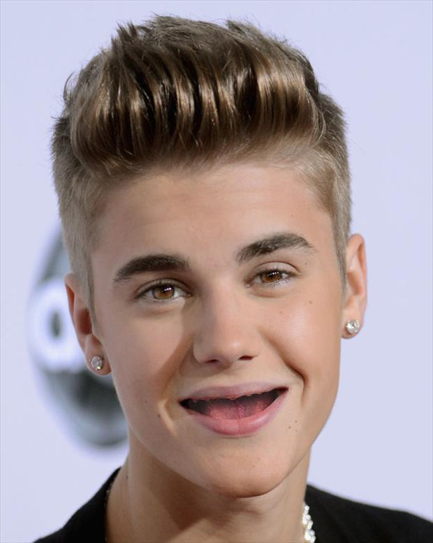 Justin Bieber Without Teeth Funny Image