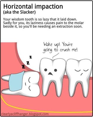 Lazy Wisdom Tooth Funny Picture