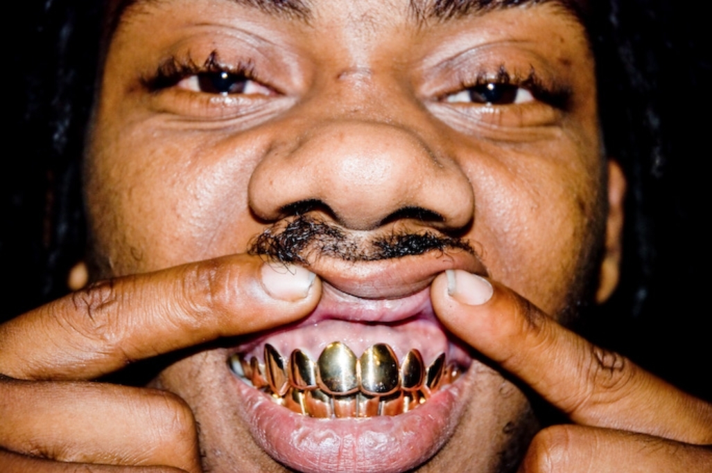 People With Golden Teeth Funny Picture.