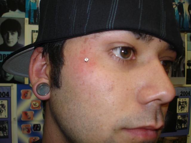 Nice Right Ear Lobe And Teardrop Piercing Picture