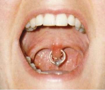 Uvula Circular Bead Ring Piercing
