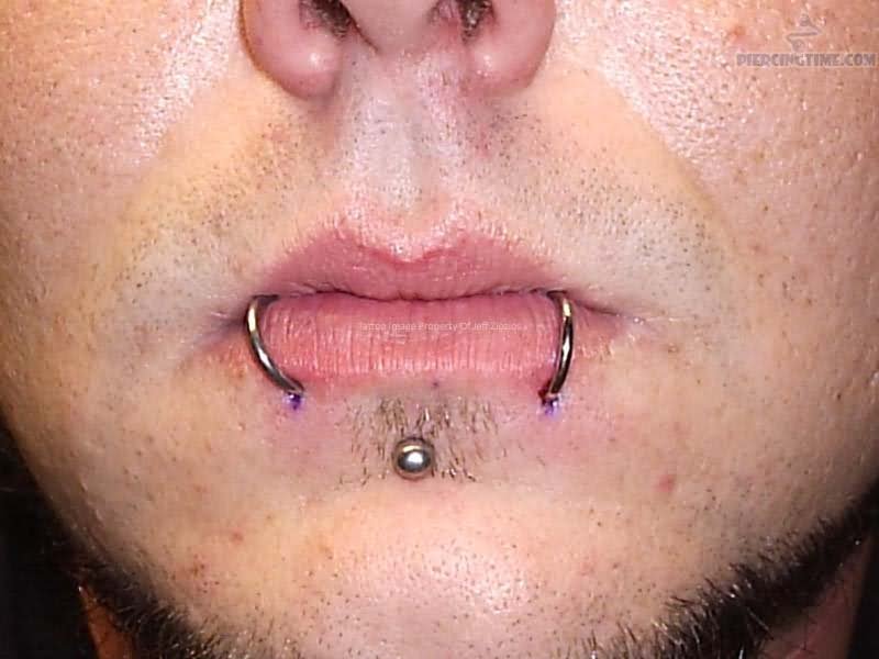 Dolphin Bites Piercing With Hoop Rings And Labret Stud