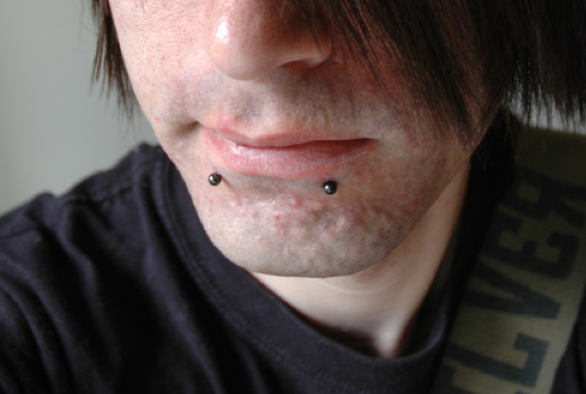 Guy With Black Studs Dolphin Bites Piercing