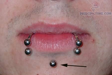 Labret And Dolphin Bites Piercing With Circular Barbell