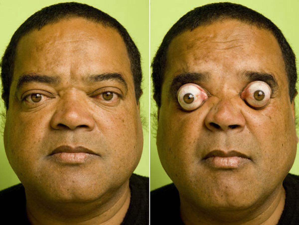 15 Most Funny Eyes Pictures And Images