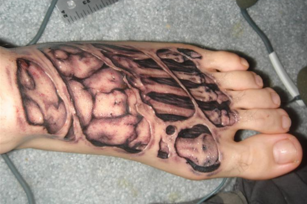 Torn Skin Foot Skeleton Tattoo On Foot