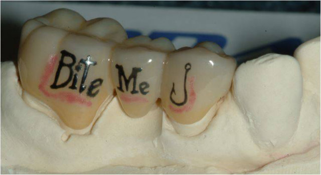 Bite Me Lettering Tattoo On Teeth