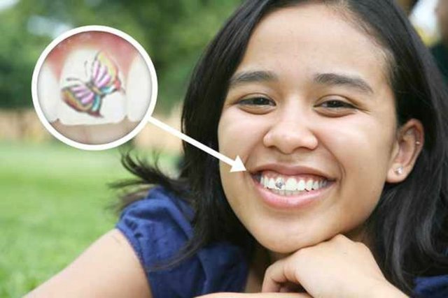 Colorful Butterfly Tattoo On Teeth