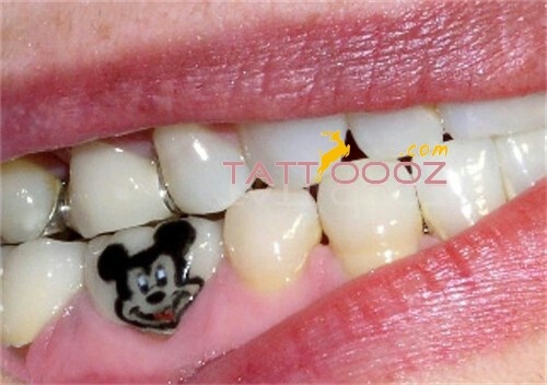 Mickey Mouse Head Tattoo On Teeth