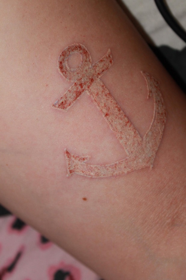 Anchor White Ink Tattoo On Arm