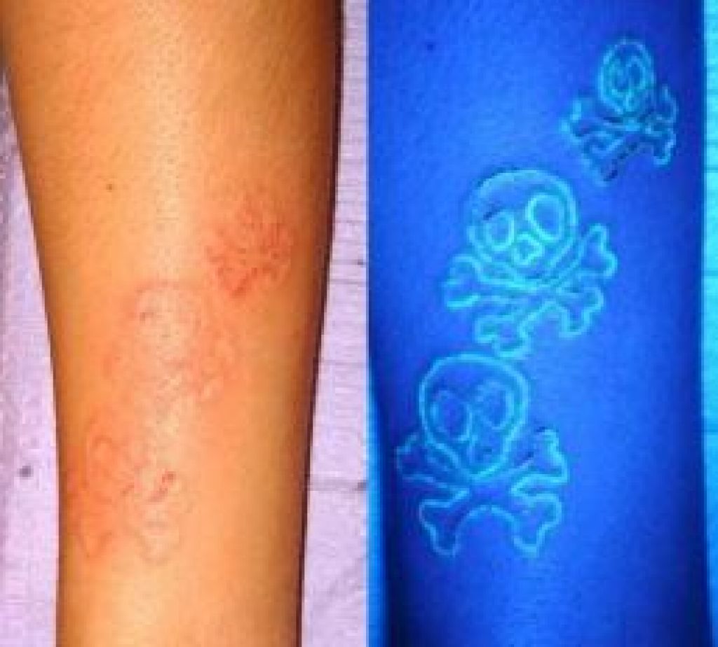 Danger Skulls White Ink Tattoo On Arm