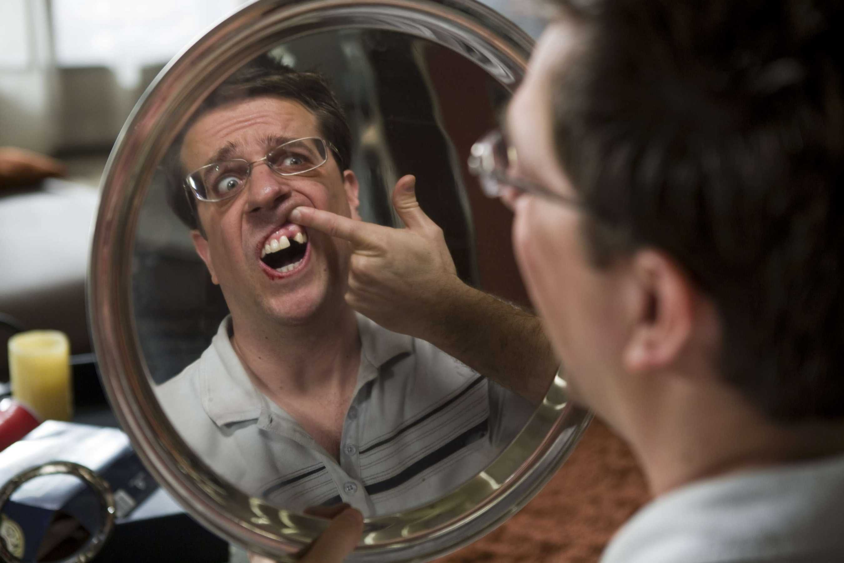 Man See Himself In To Mirror With One Missing Tooth Funny Picture