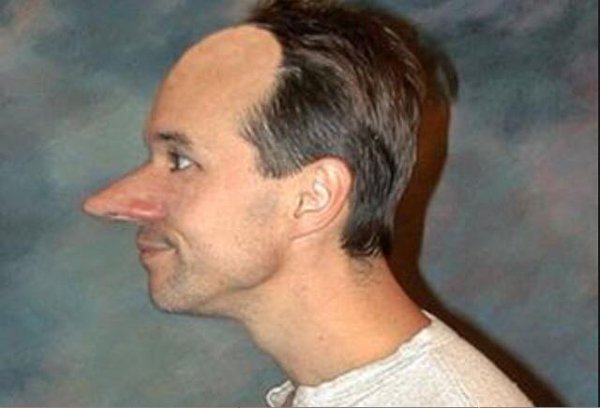 Man With Funny Peaked Nose