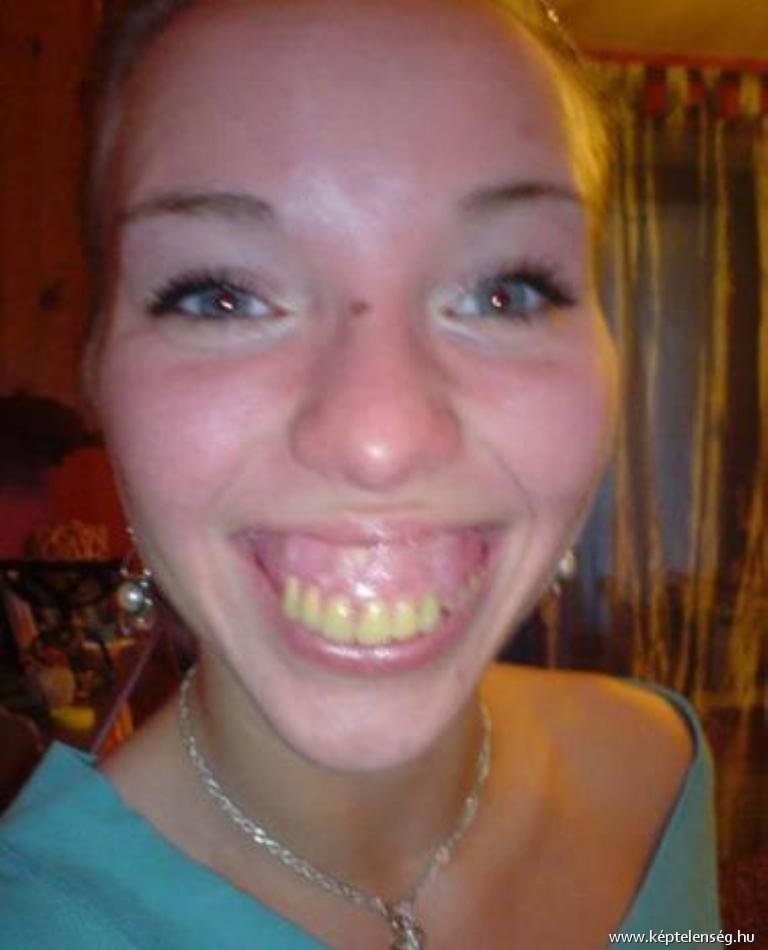 Yellow Teeth Girl Funny Smiley Face