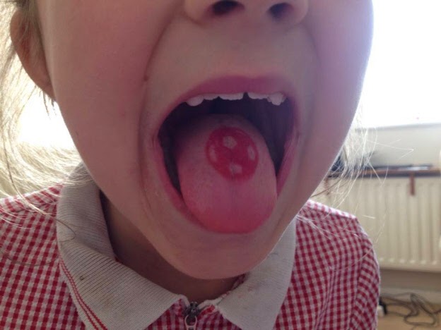 Red Football Tattoo On Baby Girl Tongue
