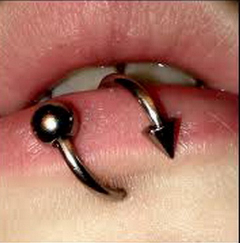 Spiral Lip Piercing Closeup Image