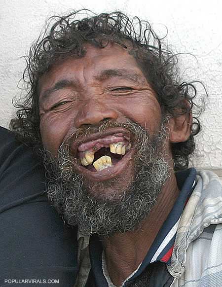 Funny Teeth Man Laughing Picture