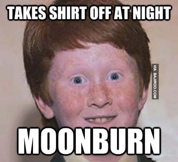 Takes Shirt Off At Night Moon Burn Funny Meme Image