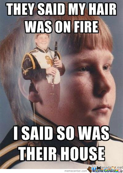 They Said My Hair Was On Fire Funny Burn Image