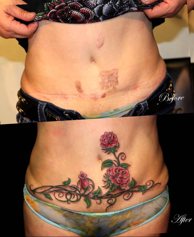 Red Roses Tattoo On After Pregnancy Belly