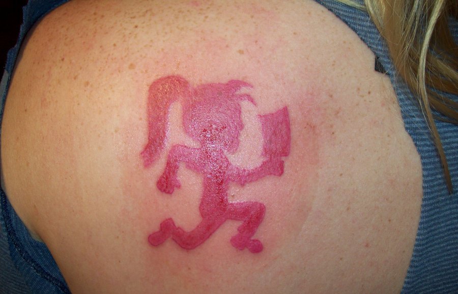 Red ICP Girl Logo Tattoo Design For Shoulder