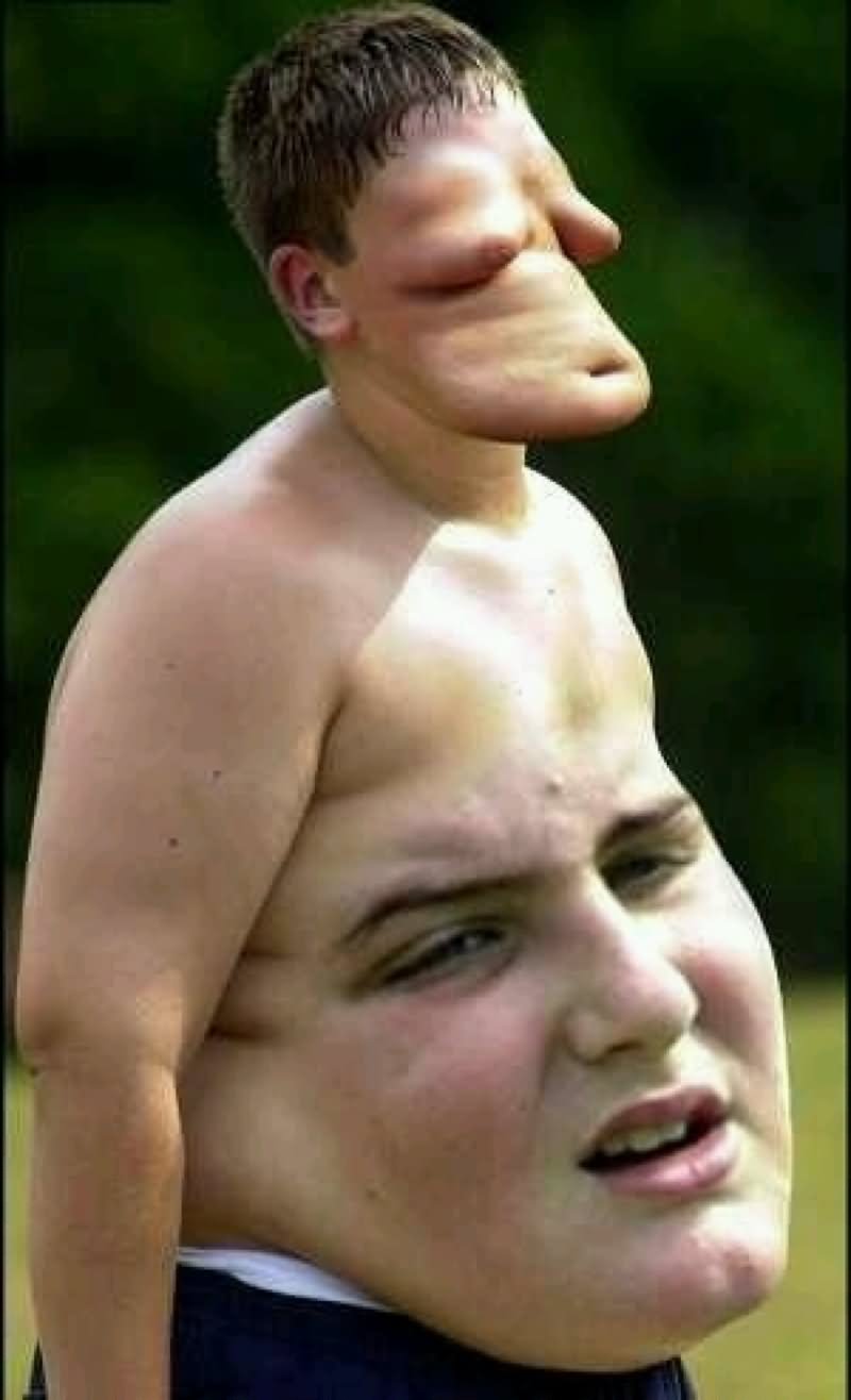 Tummy Face Swap Funny Photoshopped Image