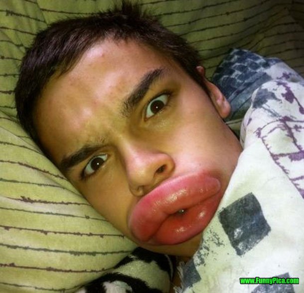 Boy With Very Funny Duck Face