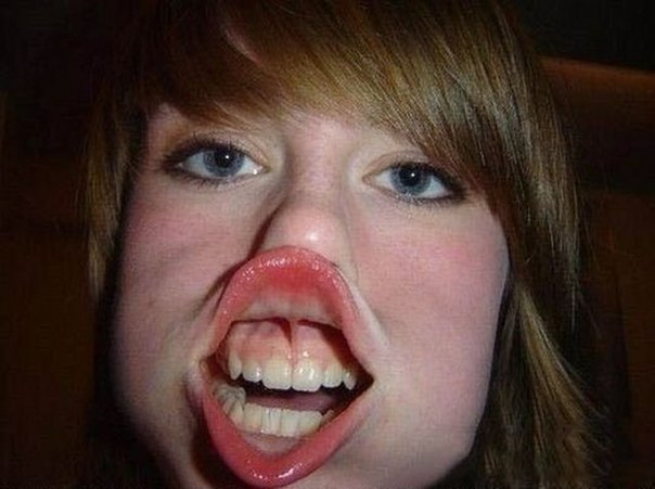 Funny Girl With Duck Face Lips Picture For Facebook
