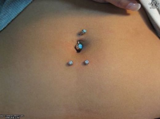 Blue Jewel Belly Piercing And Surface Belly Piercing