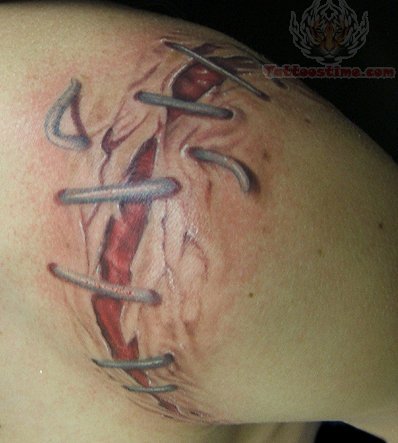 Stitched Torn Ripped Skin Tattoo On Man Shoulder