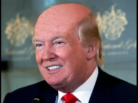 Bald Donald Trump Funny Picture