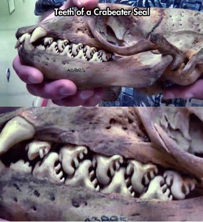 Teeth Of A Crabeater Seal Funny Teeth Meme Image