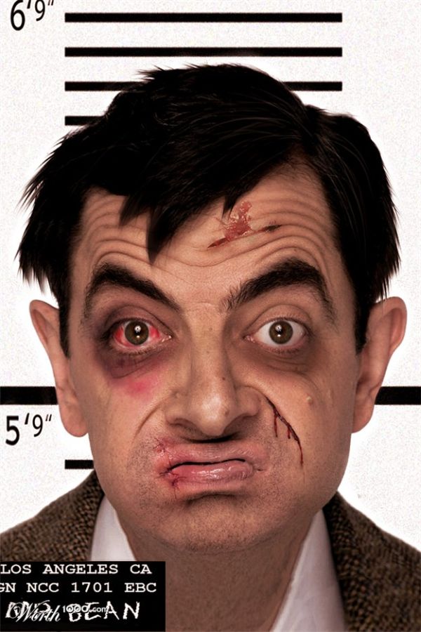 Mr Bean With Injured Face Funny Image