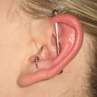 Anti Tragus To Industrial Piercing On Left Ear