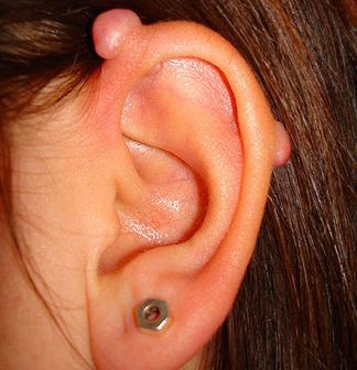 Implants Industrial Piercing On Girl Left Ear