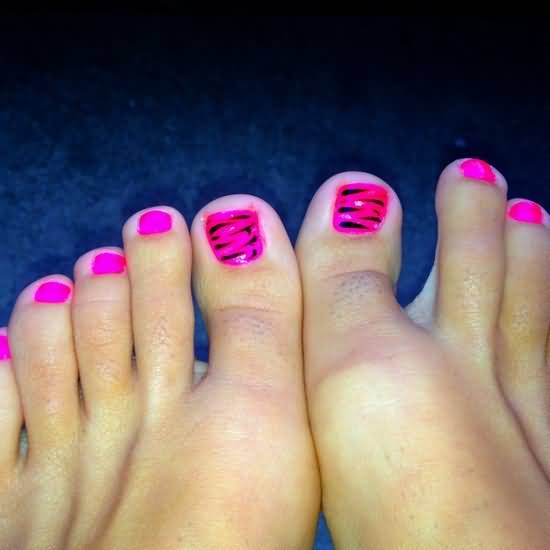Neon Pink Zebra Stripes Toe Nail Art